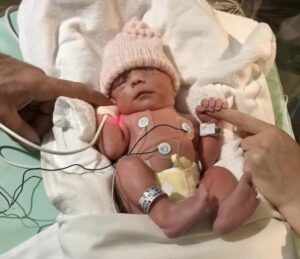 prematurite prematurite